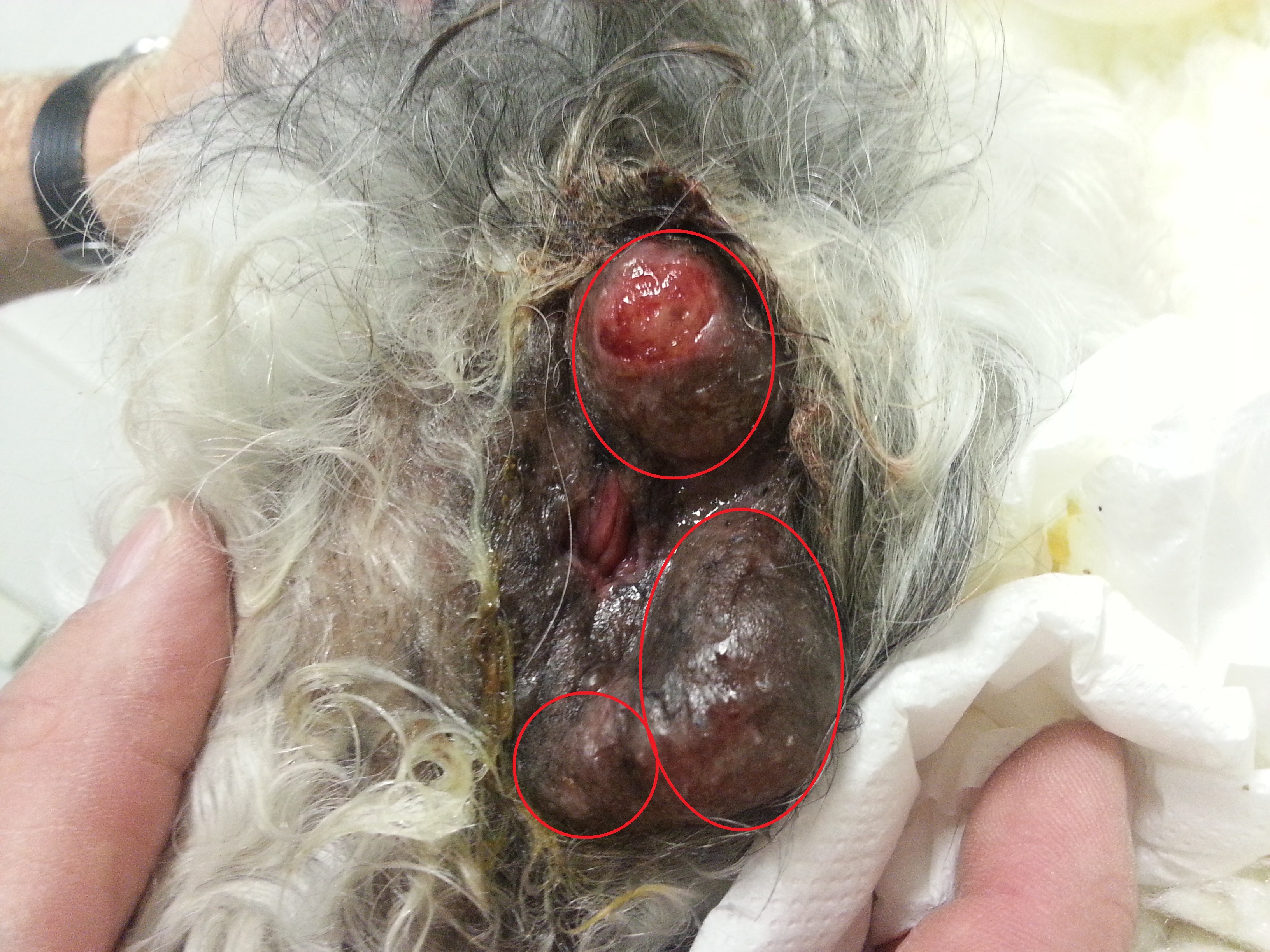 Circumanaalkliertumor1