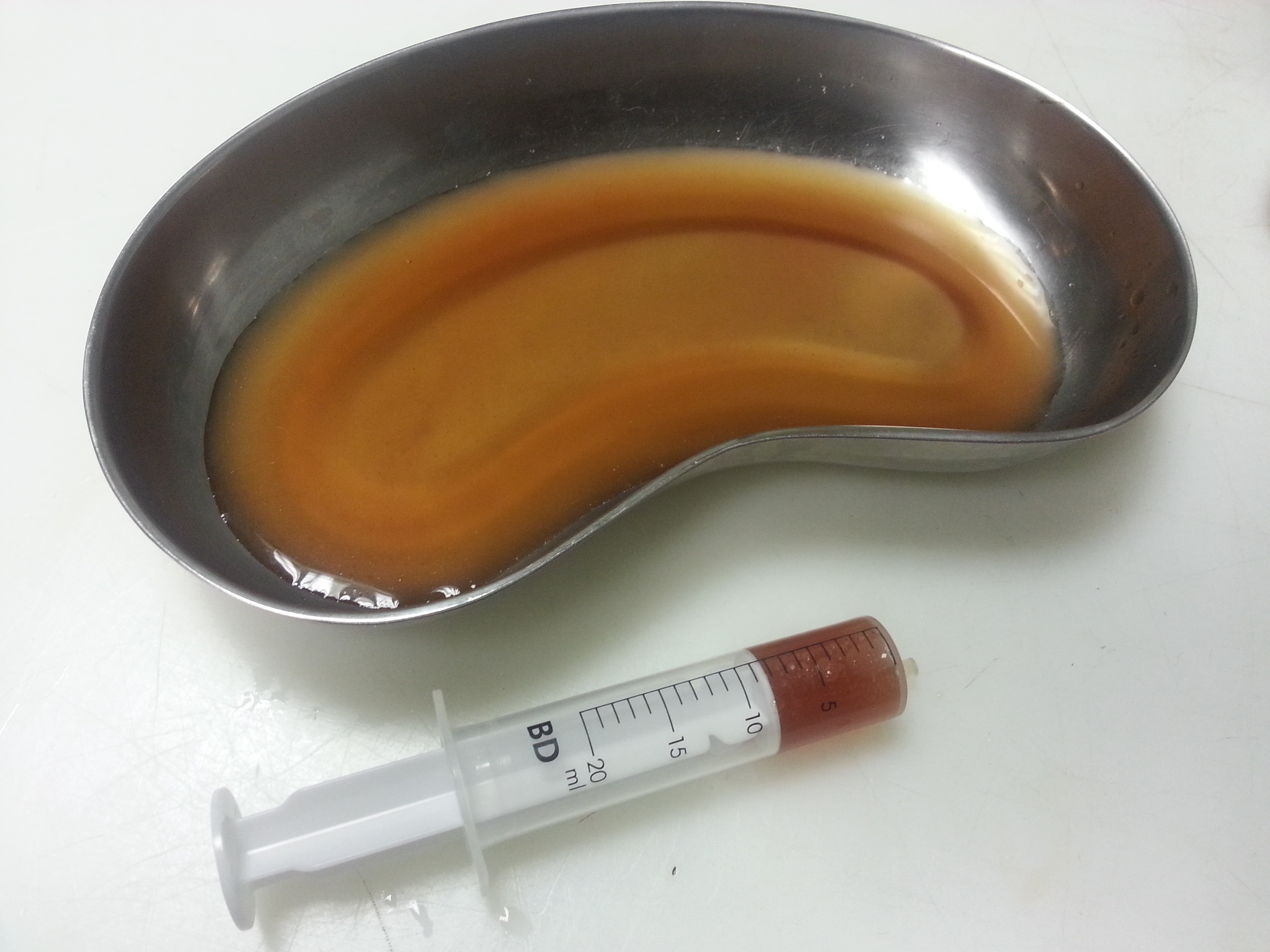 Gecatheteriseerdekater1