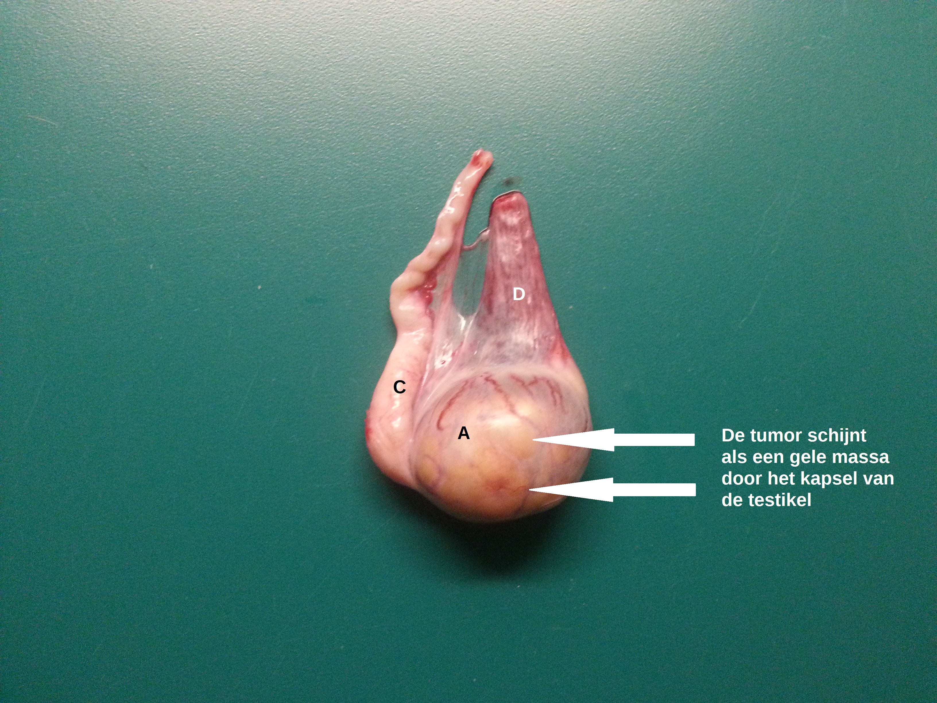Testkeltumor2