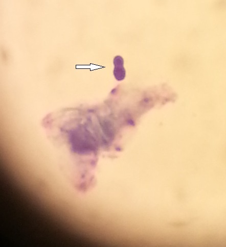 Malassezia